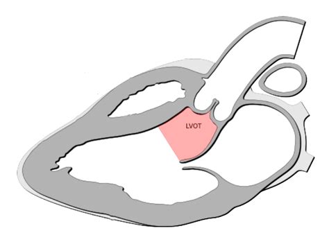 left ventricular outflow.